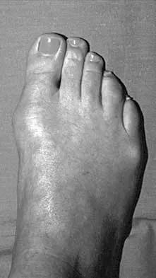 General Orthopedics 2026 Practice Questions: Set 1 (Solved) - Figure 38