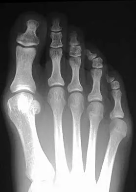 General Orthopedics 2026 Practice Questions: Set 1 (Solved) - Figure 39