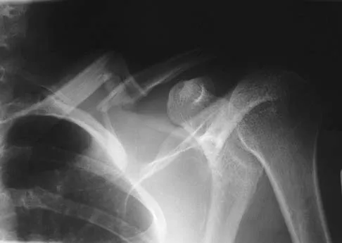 General Orthopedics 2026 Practice Questions: Set 1 (Solved) - Figure 4