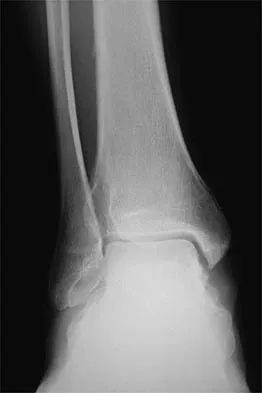 General Orthopedics 2026 Practice Questions: Set 1 (Solved) - Figure 41