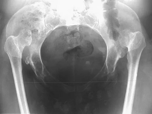 General Orthopedics 2026 Practice Questions: Set 1 (Solved) - Figure 44