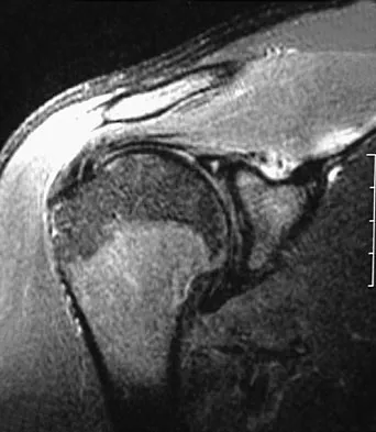 General Orthopedics 2026 Practice Questions: Set 1 (Solved) - Figure 47