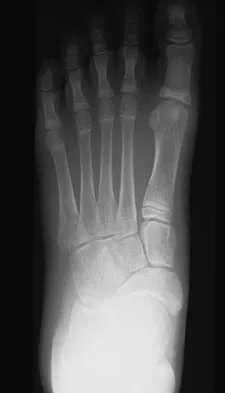 General Orthopedics 2026 Practice Questions: Set 1 (Solved) - Figure 55