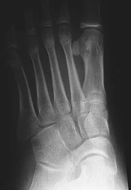 General Orthopedics 2026 Practice Questions: Set 1 (Solved) - Figure 56