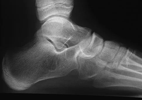 General Orthopedics 2026 Practice Questions: Set 1 (Solved) - Figure 57