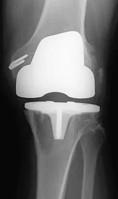 General Orthopedics 2026 Practice Questions: Set 1 (Solved) - Figure 58