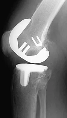 General Orthopedics 2026 Practice Questions: Set 1 (Solved) - Figure 59
