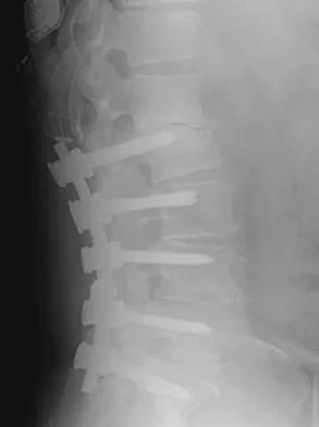 General Orthopedics 2026 Practice Questions: Set 1 (Solved) - Figure 60