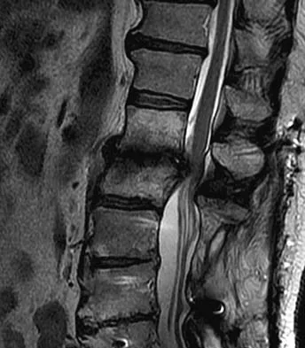 General Orthopedics 2026 Practice Questions: Set 1 (Solved) - Figure 61