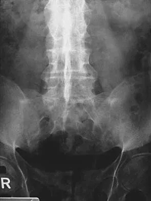 General Orthopedics 2026 Practice Questions: Set 1 (Solved) - Figure 63
