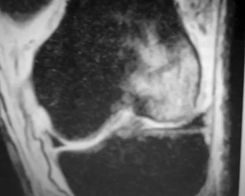 General Orthopedics 2026 Practice Questions: Set 1 (Solved) - Figure 65