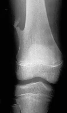 General Orthopedics 2026 Practice Questions: Set 1 (Solved) - Figure 68