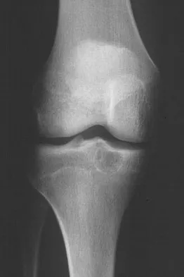 General Orthopedics 2026 Practice Questions: Set 1 (Solved) - Figure 70