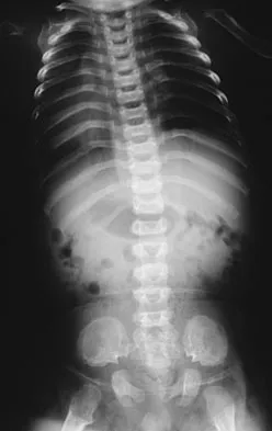 General Orthopedics 2026 Practice Questions: Set 1 (Solved) - Figure 79