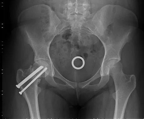General Orthopedics 2026 Practice Questions: Set 1 (Solved) - Figure 80