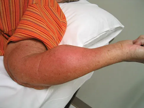 General Orthopedics 2026 Practice Questions: Set 1 (Solved) - Figure 84