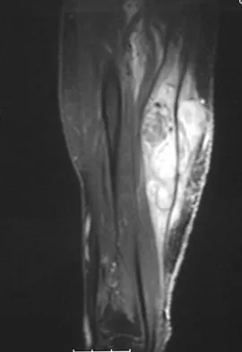 General Orthopedics 2026 Practice Questions: Set 1 (Solved) - Figure 85
