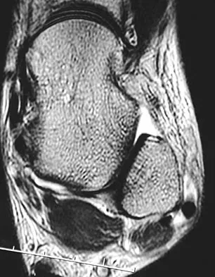 General Orthopedics 2026 Practice Questions: Set 1 (Solved) - Figure 91