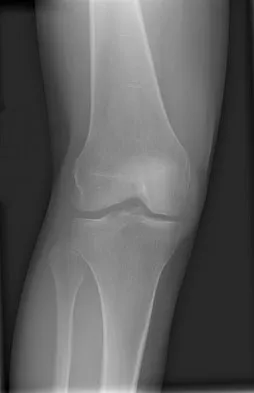 General Orthopedics 2026 Practice Questions: Set 1 (Solved) - Figure 93
