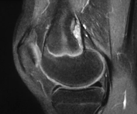 General Orthopedics Board Review 2026: High-Yield MCQs (Set 10) - Figure 11
