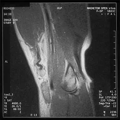 General Orthopedics Board Review 2026: High-Yield MCQs (Set 10) - Figure 13