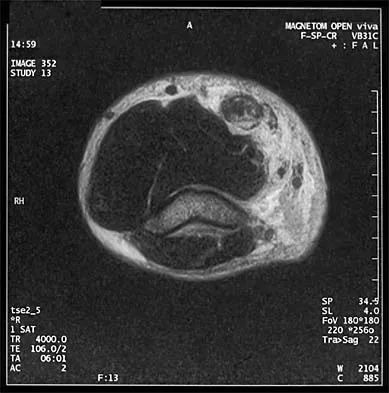 General Orthopedics Board Review 2026: High-Yield MCQs (Set 10) - Figure 14