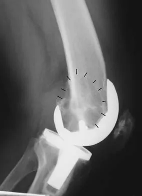 General Orthopedics Board Review 2026: High-Yield MCQs (Set 10) - Figure 16