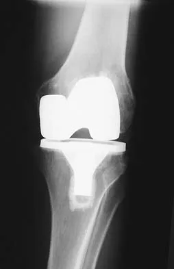General Orthopedics Board Review 2026: High-Yield MCQs (Set 10) - Figure 17