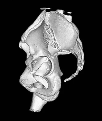 General Orthopedics Board Review 2026: High-Yield MCQs (Set 10) - Figure 2