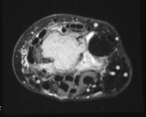 General Orthopedics Board Review 2026: High-Yield MCQs (Set 10) - Figure 27