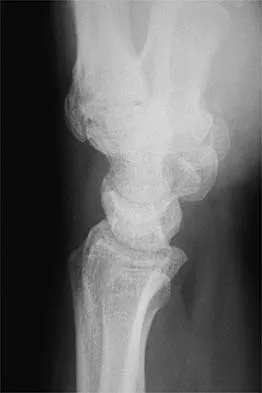 General Orthopedics Board Review 2026: High-Yield MCQs (Set 10) - Figure 30