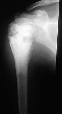 General Orthopedics Board Review 2026: High-Yield MCQs (Set 10) - Figure 31