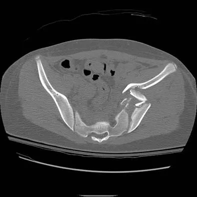 General Orthopedics Board Review 2026: High-Yield MCQs (Set 10) - Figure 4