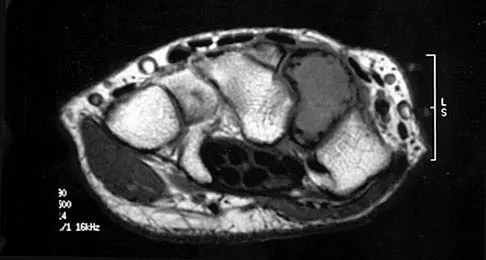 General Orthopedics Board Review 2026: High-Yield MCQs (Set 10) - Figure 41