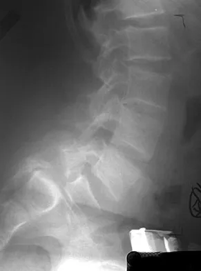 General Orthopedics Board Review 2026: High-Yield MCQs (Set 10) - Figure 43