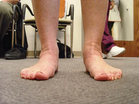 General Orthopedics Board Review 2026: High-Yield MCQs (Set 10) - Figure 46