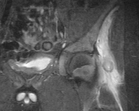 General Orthopedics Board Review 2026: High-Yield MCQs (Set 10) - Figure 49