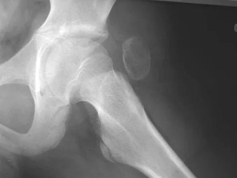 General Orthopedics Board Review 2026: High-Yield MCQs (Set 10) - Figure 50