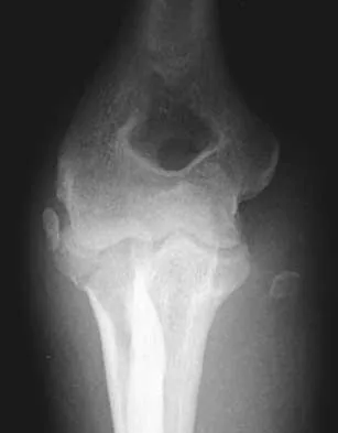 General Orthopedics Board Review 2026: High-Yield MCQs (Set 10) - Figure 56