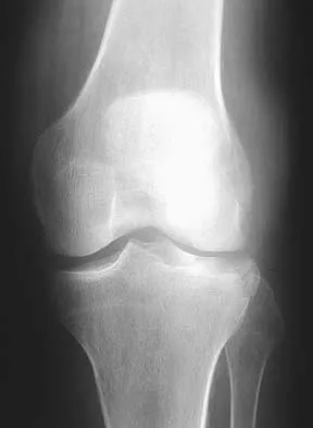 General Orthopedics Board Review 2026: High-Yield MCQs (Set 10) - Figure 6