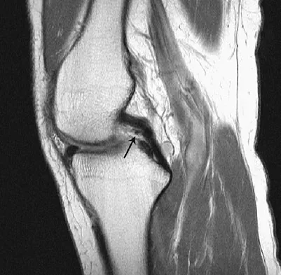 General Orthopedics Board Review 2026: High-Yield MCQs (Set 10) - Figure 62