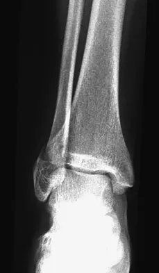 General Orthopedics Board Review 2026: High-Yield MCQs (Set 10) - Figure 64
