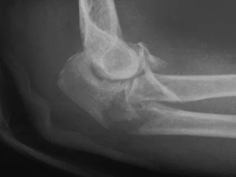 General Orthopedics Board Review 2026: High-Yield MCQs (Set 10) - Figure 65