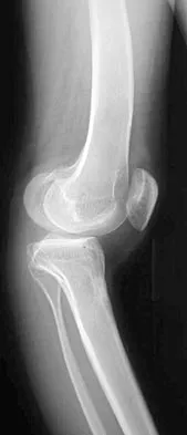 General Orthopedics Board Review 2026: High-Yield MCQs (Set 10) - Figure 67