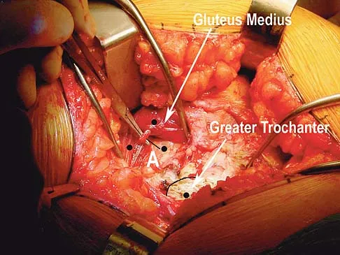 General Orthopedics Board Review 2026: High-Yield MCQs (Set 10) - Figure 74