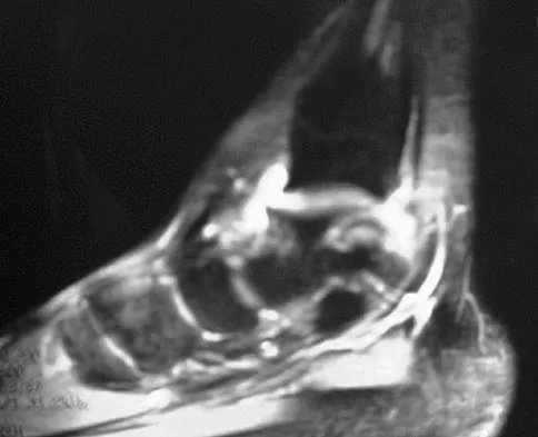 General Orthopedics Board Review 2026: High-Yield MCQs (Set 10) - Figure 77