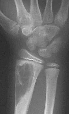 General Orthopedics Board Review 2026: High-Yield MCQs (Set 10) - Figure 78