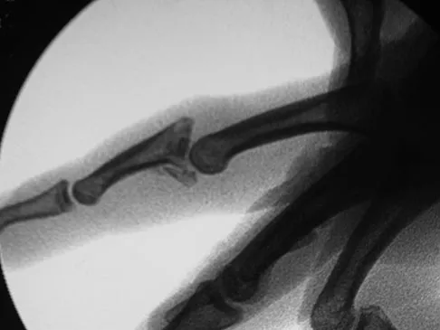 General Orthopedics Board Review 2026: High-Yield MCQs (Set 10) - Figure 82