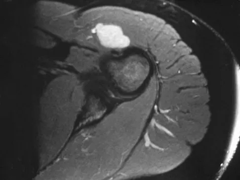 General Orthopedics Board Review 2026: High-Yield MCQs (Set 10) - Figure 92