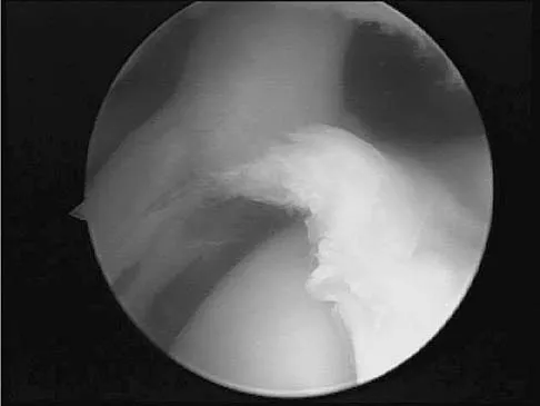 General Orthopedics 2026 Practice Questions: Set 11 (Solved) - Figure 12